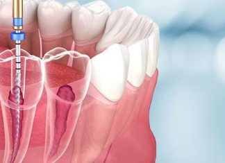 Удаление зубов в Сургуте: внимание к пациенту и безупречная стерильность