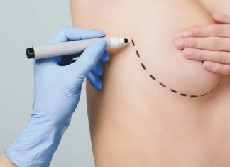 Коррекция ареолы груди: как вернуть эстетику и уверенность в себе