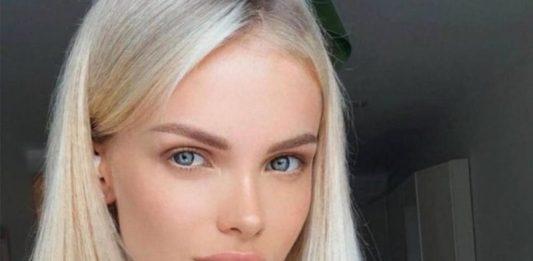 Лишившаяся части головы модель Анжелика Тартанова помирилась с бывшим-истязателем