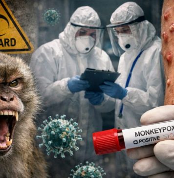 Смертельная оспа обезьян добралась до Подмосковья: пациента срочно изолировали