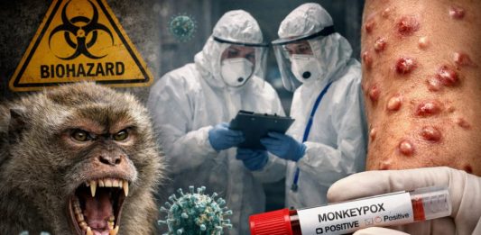 Смертельная оспа обезьян добралась до Подмосковья: пациента срочно изолировали